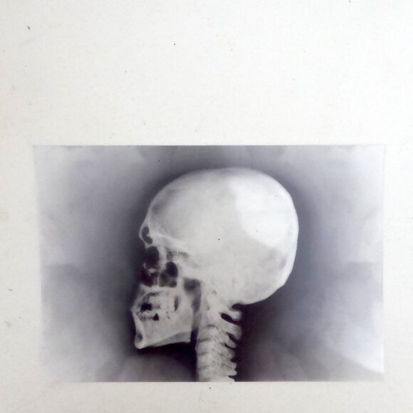 6” x 4” 24 HALLOWEEN ACETATE PLASTIC PAPER X-RAY IMAGE PAD - Picture 7 of 10